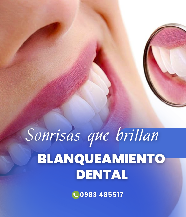 BLANQUEAMIENTO