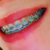 Thumbnail ORTODONCIA0
